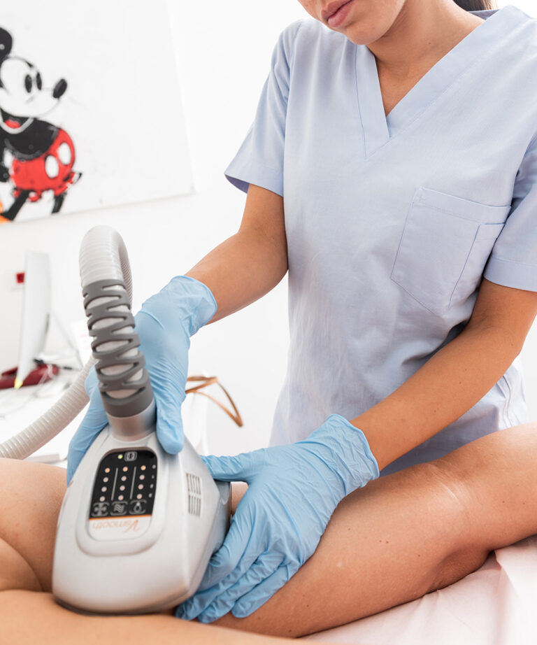 Velashape 2