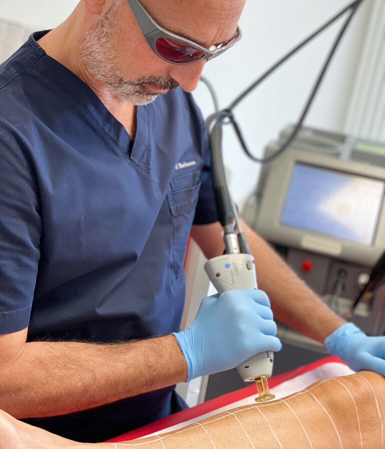 Epilazione Laser Cosce